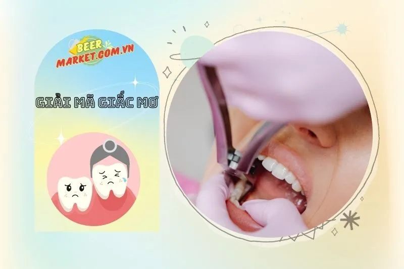 Con Số May Mắn Liên Quan Đến Giấc Mơ Nhổ Răng