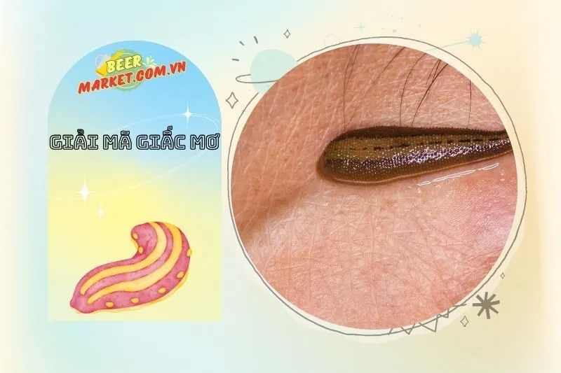 Làm Thế Nào Để Giải Tỏa Lo Lắng Sau Khi Nằm Mơ Thấy Đỉa?