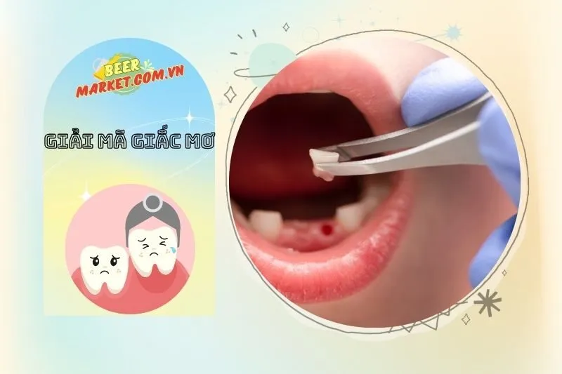 Mơ Thấy Mình Nhổ Răng Cho Con Cái