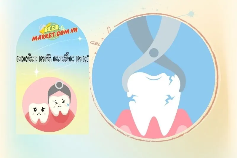 Mơ Thấy Nhổ Răng: Điềm Báo Gì?