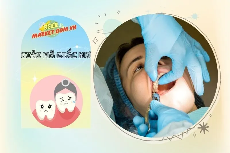 Mối Quan Hệ Giữa Giấc Mơ Nhổ Răng và Sức Khỏe Tinh Thần