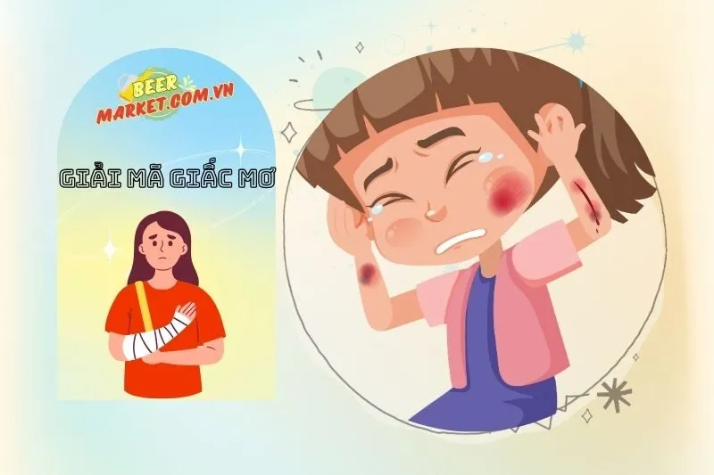 Hướng dẫn giải mã chi tiết từng loại giấc mơ bị thương